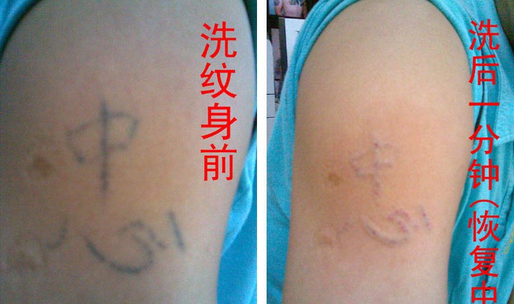 專業(yè)紋繡培訓武漢專業(yè)洗紋身QQ：313998629 洗紋身專業(yè)店