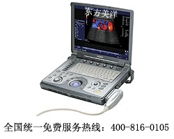 供應(yīng) SonoAce X8 