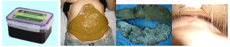 深圳中藥泥灸加盟招商 中藥泥灸加工批發(fā)