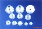 ……》生物濾池過濾水用蜂窩斜管，沉淀除砂用·