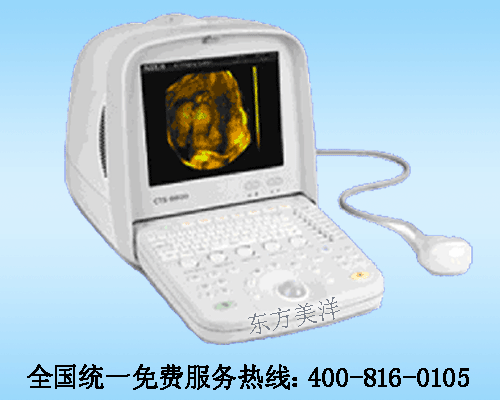 CTS-7700型全數(shù)字超聲顯像診斷儀