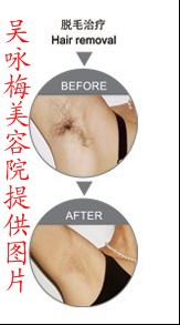 天津脫毛哪里好？