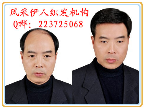 ０２２－５８５１．６５７７天津市|寶坻區|爾王莊鄉天津假發