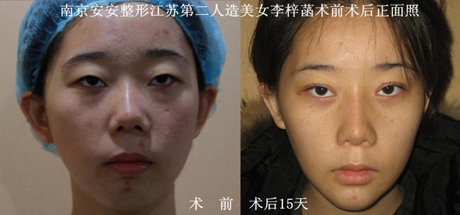 江蘇微整形專家