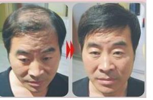 廣州哪里織發好？