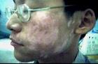 洛陽zl白癜風能治好嗎，洛陽洛浦醫(yī)院白癜風?？疲尻柊遵帮L