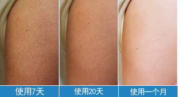 雞皮膚的注意事項,雞皮膚不應(yīng)該吃什么?原始圖片2