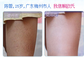 去雞皮膚{zh0}的產品    原始圖片2